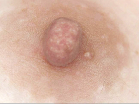 300人の乳首　4　サンプル画像05